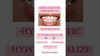 AMELOGENESIS IMPERFECTA dental anomalies enameldefects imperfecta [upl. by Annmarie]