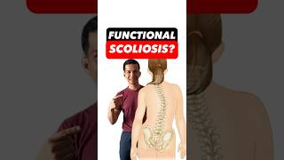 FIX SCOLIOSIS functional NATURALLY scoliosistherapy scoliosistreatment scoliosisawareness [upl. by Mongeau]