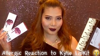 Kylie Lipkit I had an ALLERGIC REACTION [upl. by Strickland516]