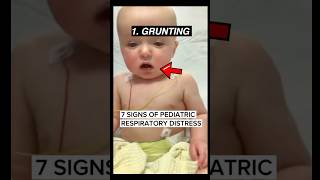 7 signs of pediatric respiratory distress emergency medicine ER medicalstudent parenting [upl. by Enitsej613]