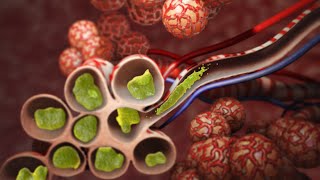 Pneumonia  Discharge Instructions  Nucleus Health [upl. by Ydissac]