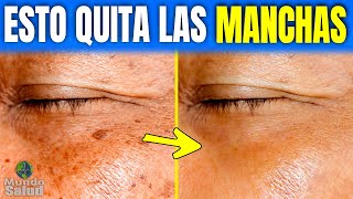 🌍 COMO QUITAR LAS MANCHAS EN LA PIEL POR LA EDAD  COMO QUITAR MANCHAS DIFICILES DE LA CARA [upl. by Gifferd]