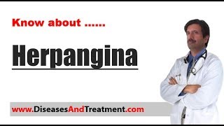 Herpangina  Causes Diagnosis Symptoms Treatment [upl. by Leibman]