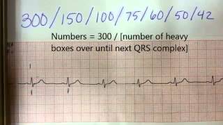 How to find heart rate pulse from EKG [upl. by Marylynne]