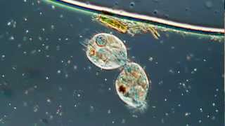 Lamour Or Cell Division in the Ciliated Protozoa Oxytricha 500X [upl. by Dot]