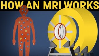 How does an MRI machine work [upl. by Maribelle]