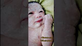 Newborn with vernix caseosababyshorts babyvideos newbornbaby [upl. by Kcirneh980]