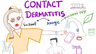 Contact Dermatitis [upl. by Lund]