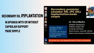 Secondary IOL Implantation made simple [upl. by Einnep]