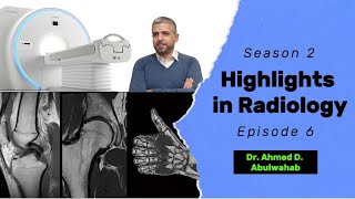 Highlights in Radiology S2 E6 anterior cruciate ligament tear [upl. by Alahcim]