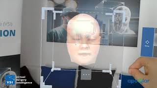 VSI HoloMedicine® Patient Education with HoloLens [upl. by Okwu]