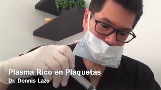 Plasma Rico en Plaquetas  Activación [upl. by Raseac980]