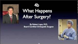 Recovery after Rotator Cuff Surgerymov [upl. by Htennaj144]