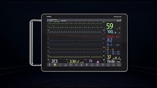 Intelligente Patientenüberwachung mit der BeneVisionFamilie [upl. by Imogene655]