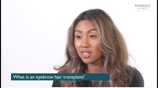 A guide to eyebrow transplants [upl. by Ayekin]