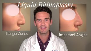 Liquid Rhinoplasty Everything you need to know [upl. by Latif660]