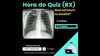 Anatomia radiográfica do tórax Traqueia [upl. by Adella]