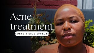 Oratane Acne Treatment  Costs  Side effects [upl. by Rosane]