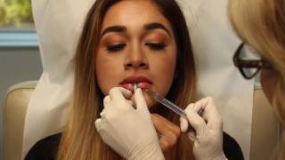 Keyhole Pout Injectable Procedure [upl. by Accire]