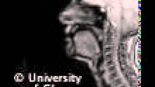 Voiceless uvular fricative MRI [upl. by Helaine]