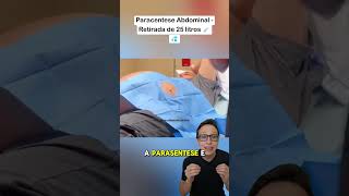 25 Litros de Ascite 😱💉 medicina medico enfermagem tecnicodeenfermagem saude barriga dágua [upl. by Aremus]