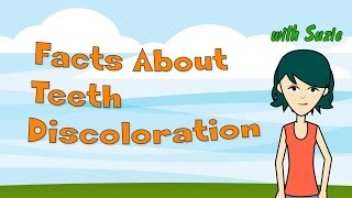 Facts About Teeth Discoloration  Teeth health [upl. by Frederigo403]