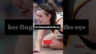 🔥Caitlin Clark Attacked 😡 No Foul for Dirty Play in WNBA Playoff Debutquot [upl. by Nevaed]