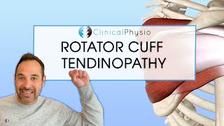 Rotator Cuff Tendinopathy  Expert Explains Mechanism Of Injury and Rehab Plan [upl. by Durman266]