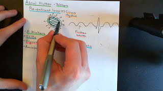 Cardiac Arrhythmias Part 5 [upl. by Atteuqihc]