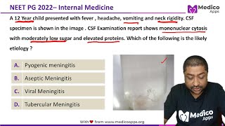 NEET PG Recall 2022 Question  Internal Medicine  Tubercular Meningitis [upl. by Eniowtna]