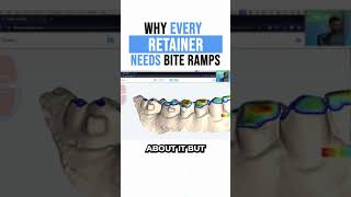 Why Every Retainer Needs Bite Ramps [upl. by Gladdie]