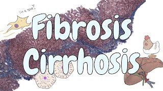 Fibrosis and cirrhosis  liver pathology [upl. by Annaid]