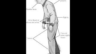 Extrapyramidal Symptoms [upl. by Lucien]