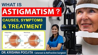 What is Astigmatism  Astigmatism Causes amp Treatment  Dr Krishna poojita  Pixel eye hospital [upl. by Doner206]