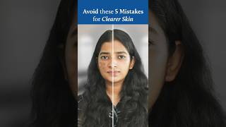 5 Dark Spot Mistakes RUINING Your Skin [upl. by Anerys]