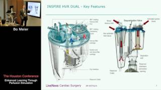 Unique Characteristics of the LivaNova Dual Reservoir Bo Meier [upl. by Alyn]