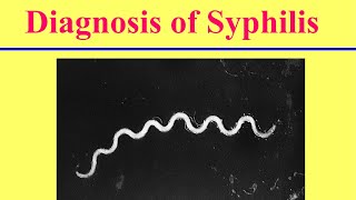 التشخيص المعملى لمرض الزهري ‏Lab Diagnosis of Syphilis [upl. by Ennavoj760]