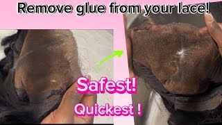 HOW TO REMOVE GLUE FROM YOUR LACE WIG Most beginner friendly tutorial quick and easy [upl. by Laubin]