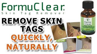 FORMUCLEAR Skin Tag Remover [upl. by Annaihs]