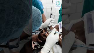 Intubation procedure doctor patient icu [upl. by Adnalu]