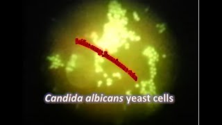 Candida albicans under Fluorescence microscope stained with Acridine Orange [upl. by Uda]