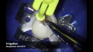 Manual Technique for Curved Root Canal Preparation [upl. by Juxon607]