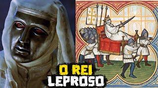 O Rei Leproso  Balduíno IV de Jerusalém  Grandes Personalidades da História  Foca na História [upl. by Lohcin]