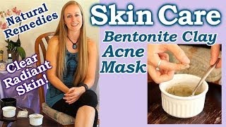 Natural Remedies for Acne Skin Care for Beauty amp Health with Bentonite Clay Acne Mask [upl. by Ruhtracm]