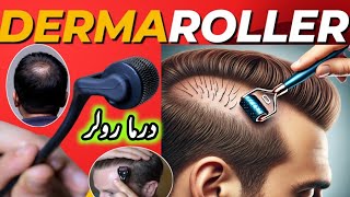 Microneedling  Derma Rolling for Hair Regrowth  Derma Roller Side Effects [upl. by Sanyu610]