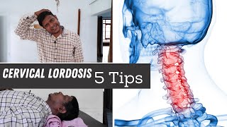 5 Best Loss of Cervical Lordosis Exercises amp Home Tips for Neck Pain [upl. by Ydospahr]