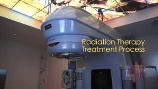 Targeting Cancer  Radiation Therapy Treatment Process [upl. by Manfred881]