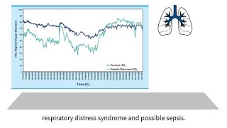 INVOS™ oximetry in the NICU Byte 10 NIRS to detect the hemodynamic impact of mechanical ventilation [upl. by Nerraj]