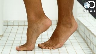 What Causes Warts [upl. by Lawton]