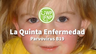 La Quinta Enfermedad Parvovirus B19 [upl. by Russom]